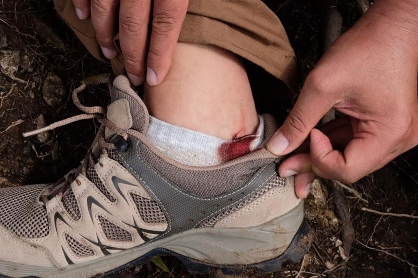 Những vết trầy xước nhẹ có thể tự xử lý 