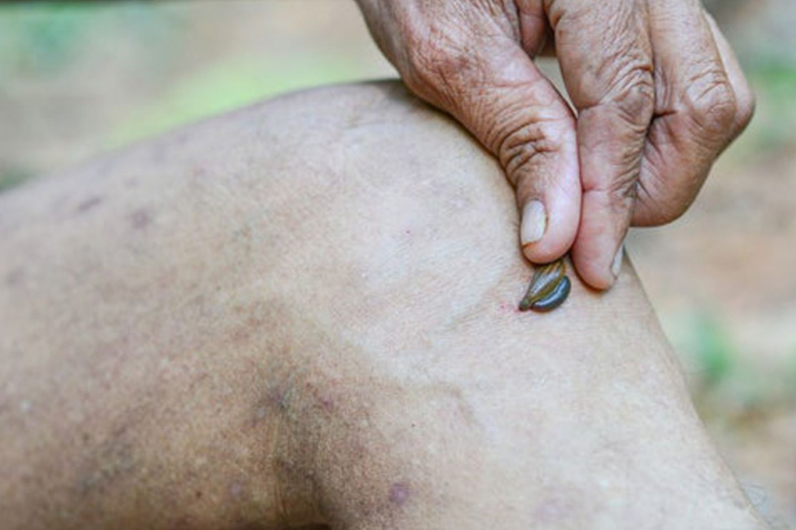 Đây là vắt khi bám lên chân người